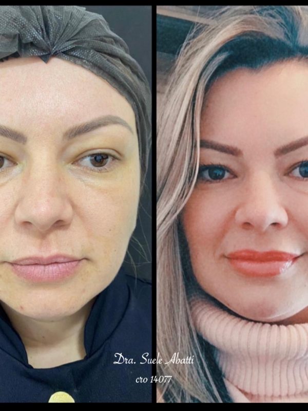 FULL FACE